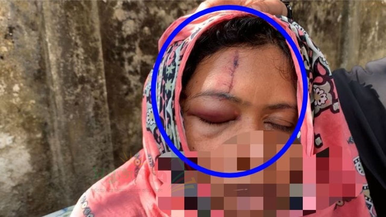 চৌদ্দগ্রামে জায়গা সংক্রান্ত বিরোধের জেরে হামলা, প্রতিবন্ধী শিশুসহ আহত ৬