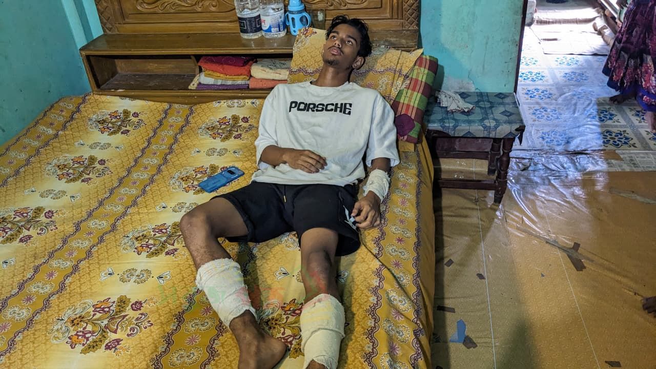 চৌদ্দগ্রামে বাকবিতন্ডার জেরে যুবককে অপহরণের পর মারধর, আড়াই লাখ টাকা ছিনতাই